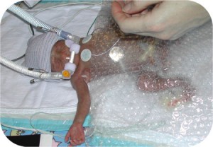 birth_zoe