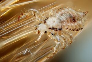Things I know about head lice…