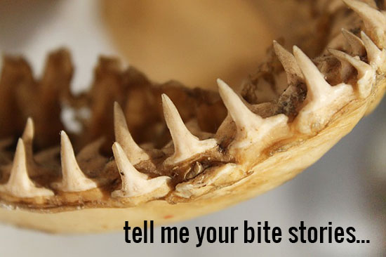 Tell us your bite story!