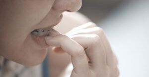 How I helped my daughter (and myself) to stop biting her nails